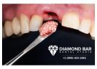 Complete Dental Care at Diamond Bar Dental Studio