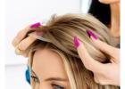 Expert Hair Loss Solutions Dallas
